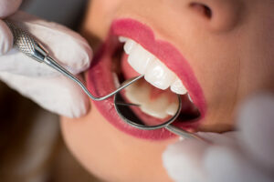 How Teeth Cleaning Helps in Maintaining Stronger Teeth and Gums