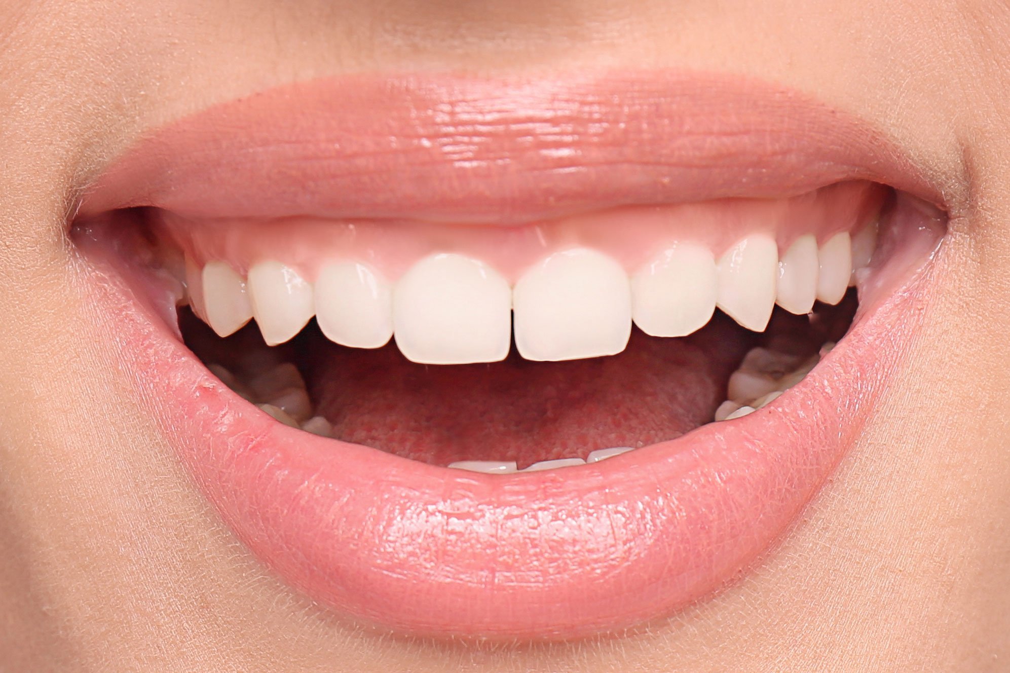 The Healing Process After Gum Contouring Tips for Quick Recovery