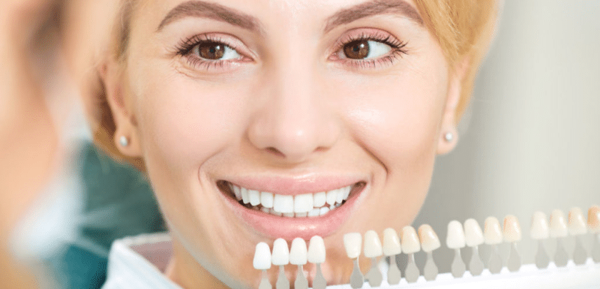 The Solution to a Perfect Smile Dental Veneers vs. Other Treatments