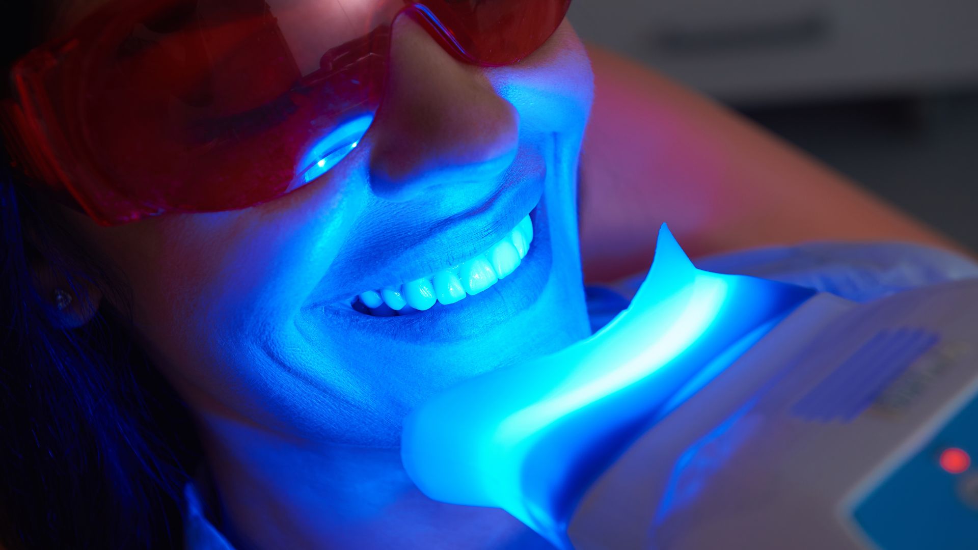 Teeth whitening