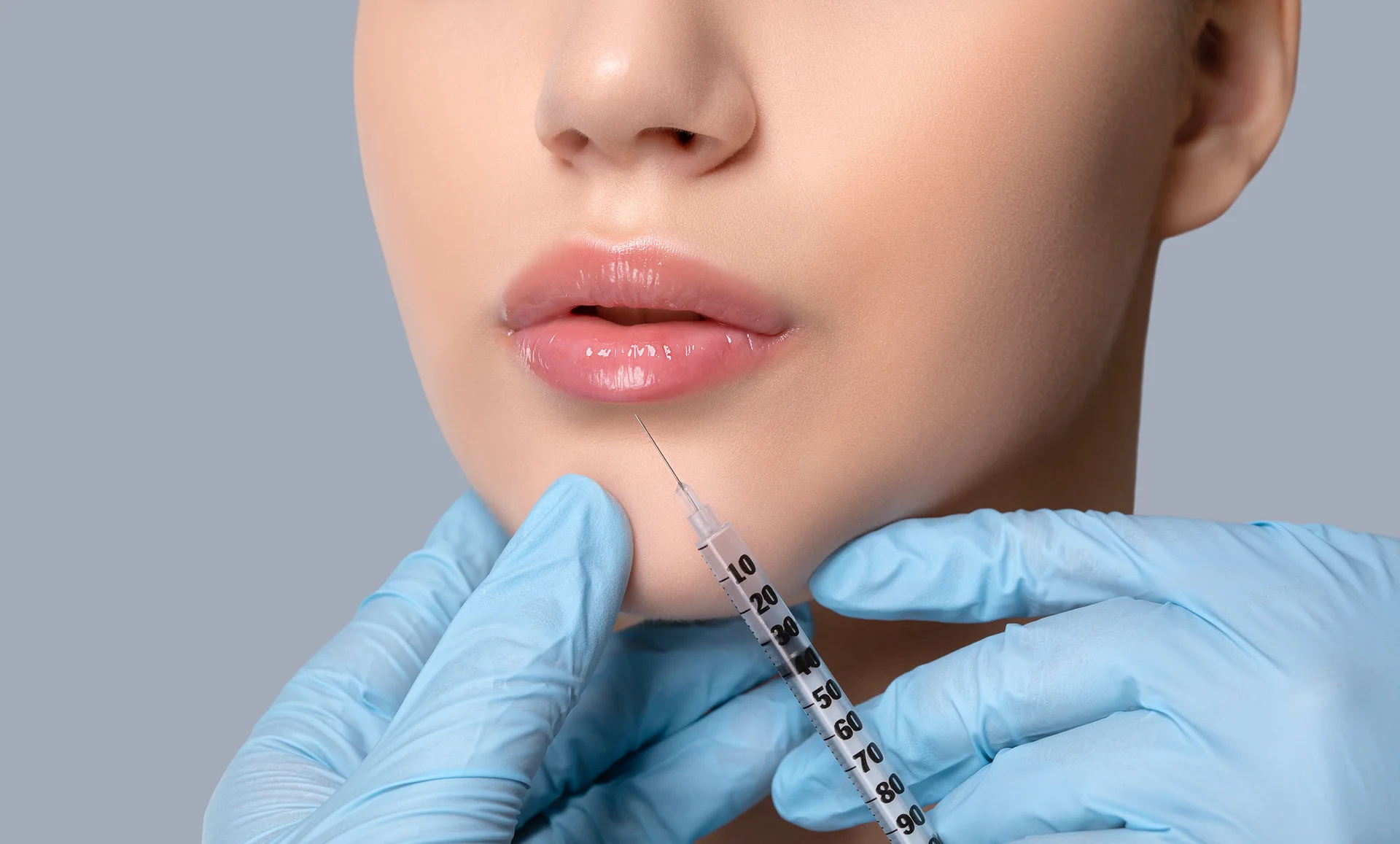 Lip filler injections in Dubai