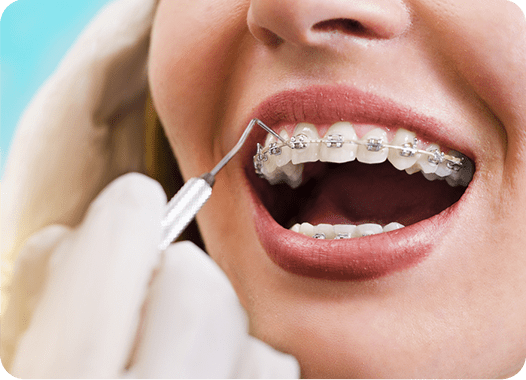 braces treatment in trimurti nagar