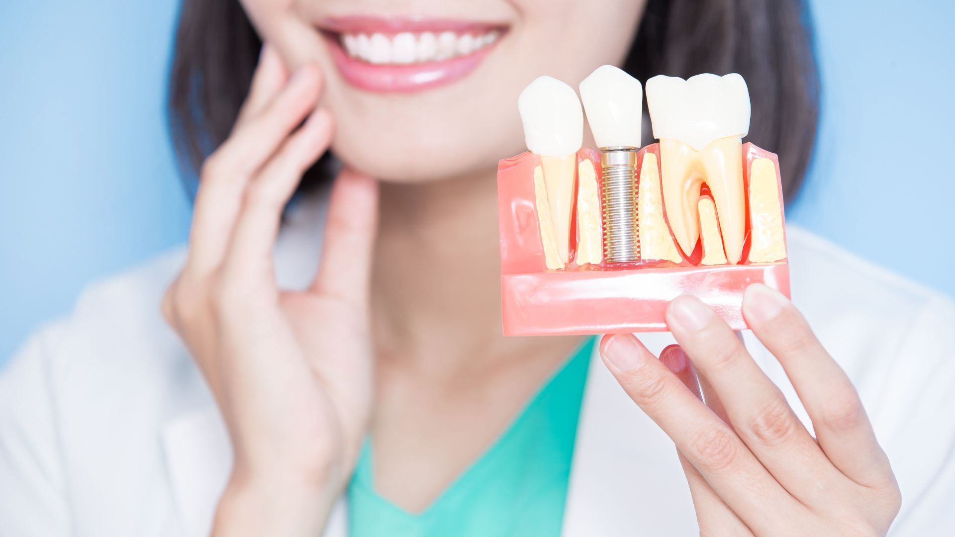 Cost and Benefits of Dental Implants Explained