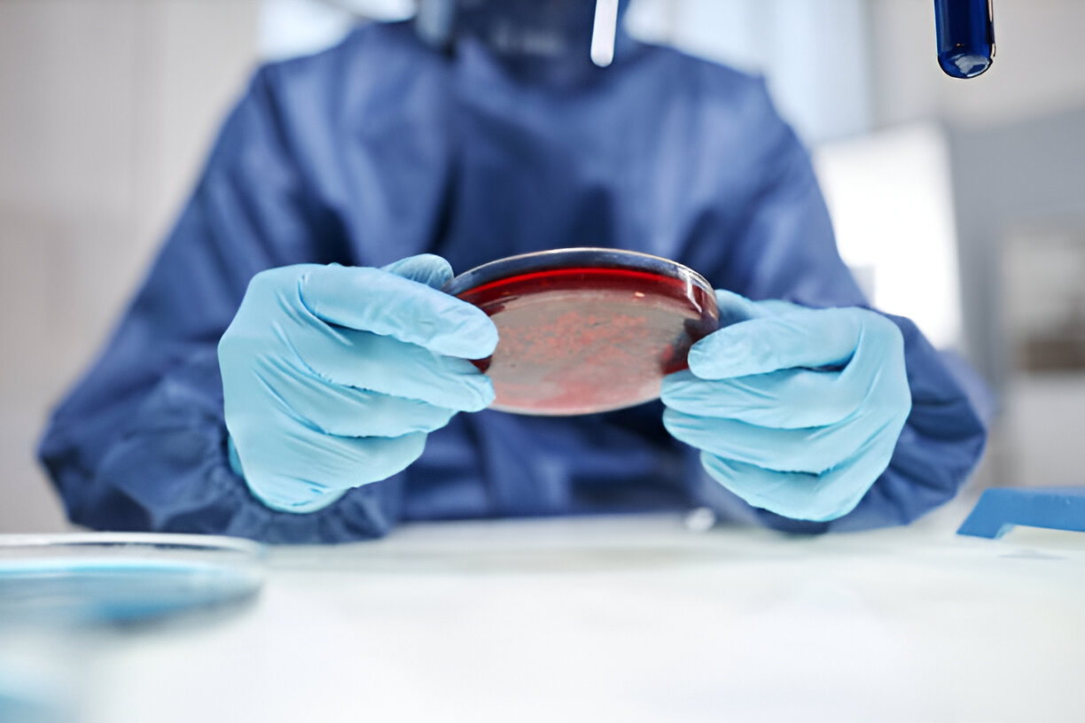 Hematopoietic stem cell transplant