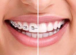 Orthodontist