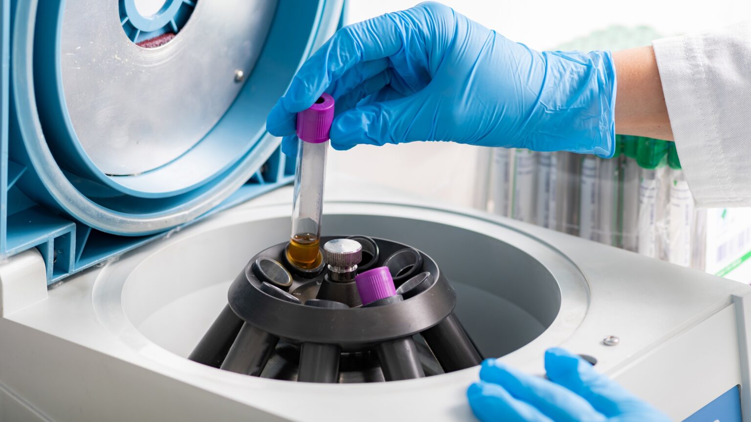 10 Must-Know Tips for Choosing the Right Laboratory Centrifuge