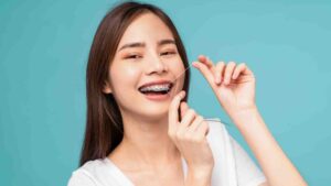 Affordable Clear Braces for a Confident Look