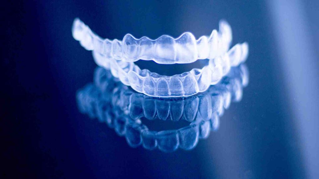 Calendrier typique du traitement Invisalign