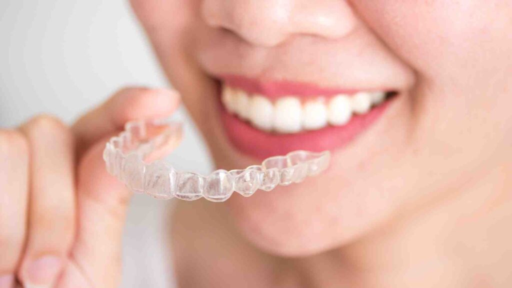 Comment commencer un traitement Invisalign à Genève ?