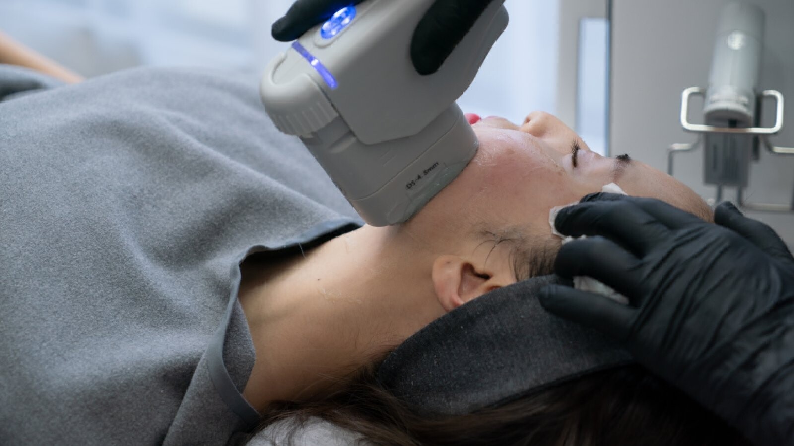 HIFU Treatment in Dubai