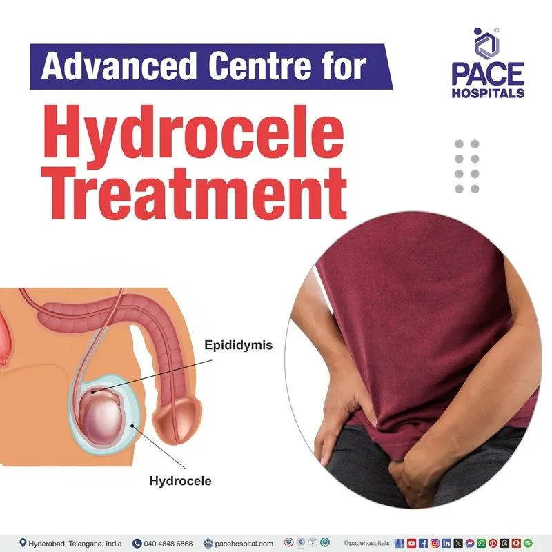 Hydrocele Hospital in Hyderabad