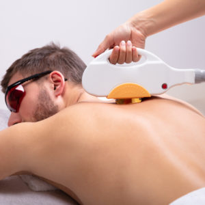 Male Laser Hair Removal Cost in Dubai