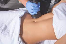 Laser Liposuction in Dubai