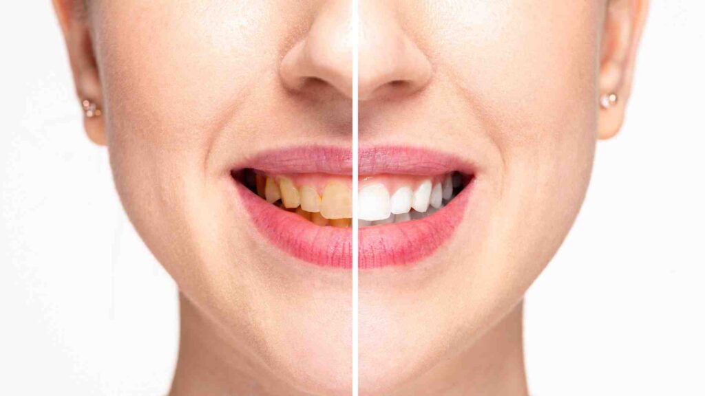 Maintenance Tips for a Longer-Lasting Smile
