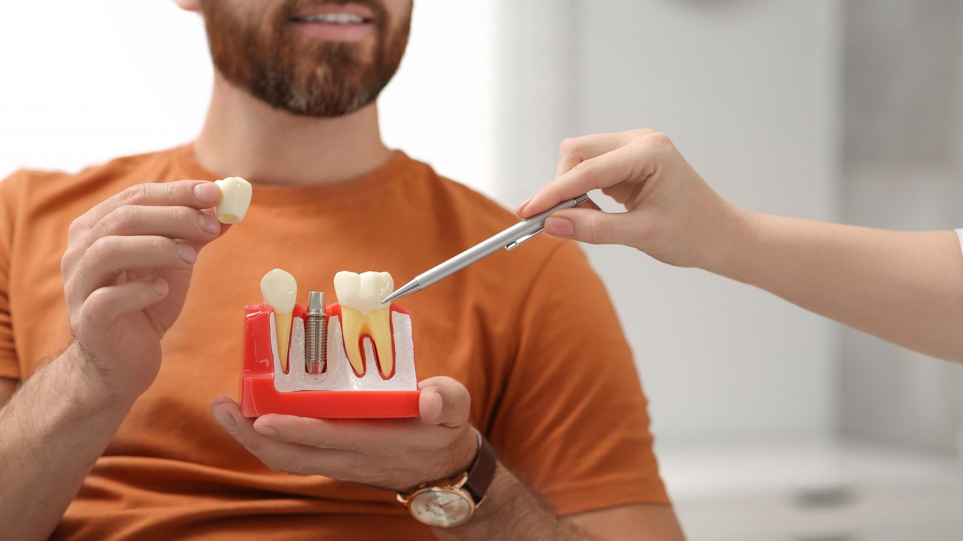 All-on-4 vs. Traditional Dental Implants: Key Differences