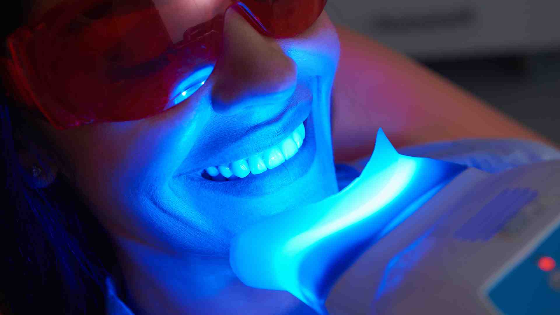 Zoom Whitening_ Whiten Your Teeth in One Visit