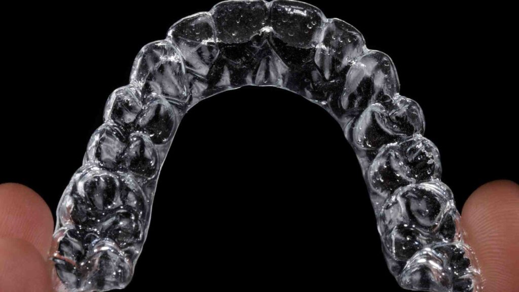 Comment commencer avec les aligneurs Invisalign ?