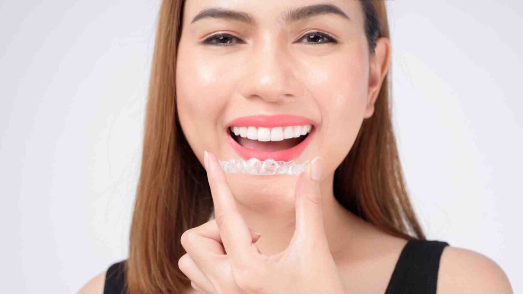 Comment des bagues abordables ont changé mon sourire