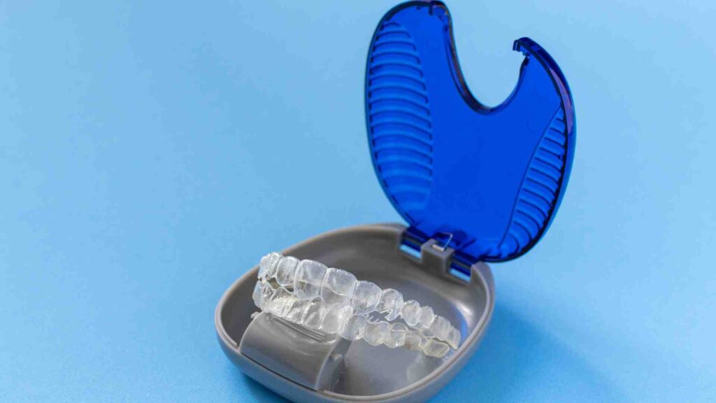 Comment fonctionne Invisalign ?