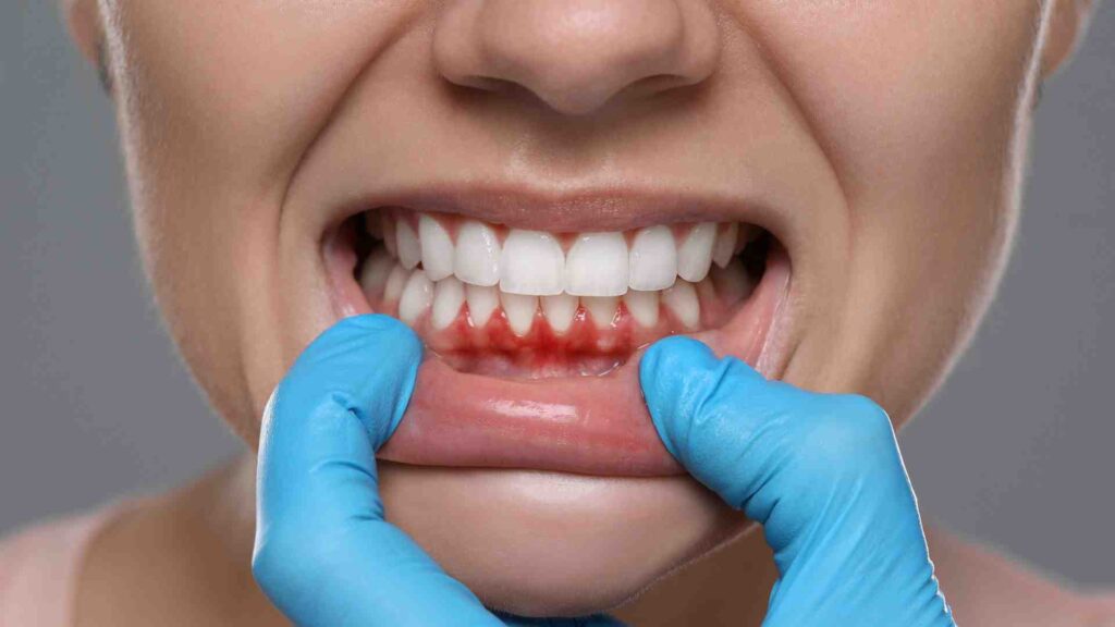 Comment prévenir les maux de dents à l'avenir ?