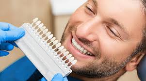 Dental Veneers in Dubai