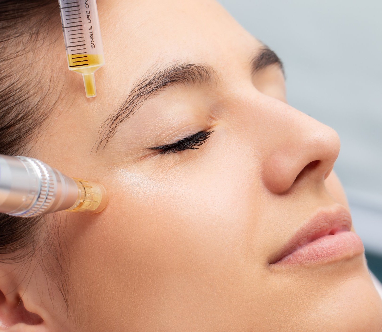 Vampire Facial in Dubai
