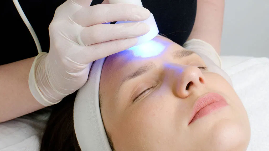 How to Prepare for Laser Skin Resurfacing