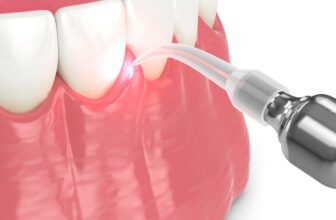 Laser Dentistry in Dubai – Advanced, Painless Dental Care