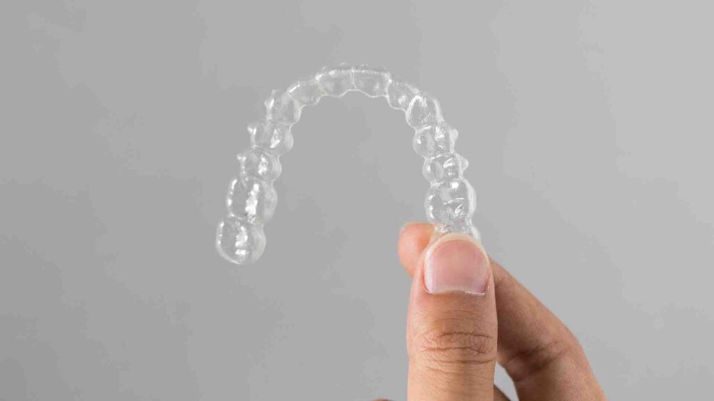Real-Life Story_ How Affordable Braces Changed My Smile