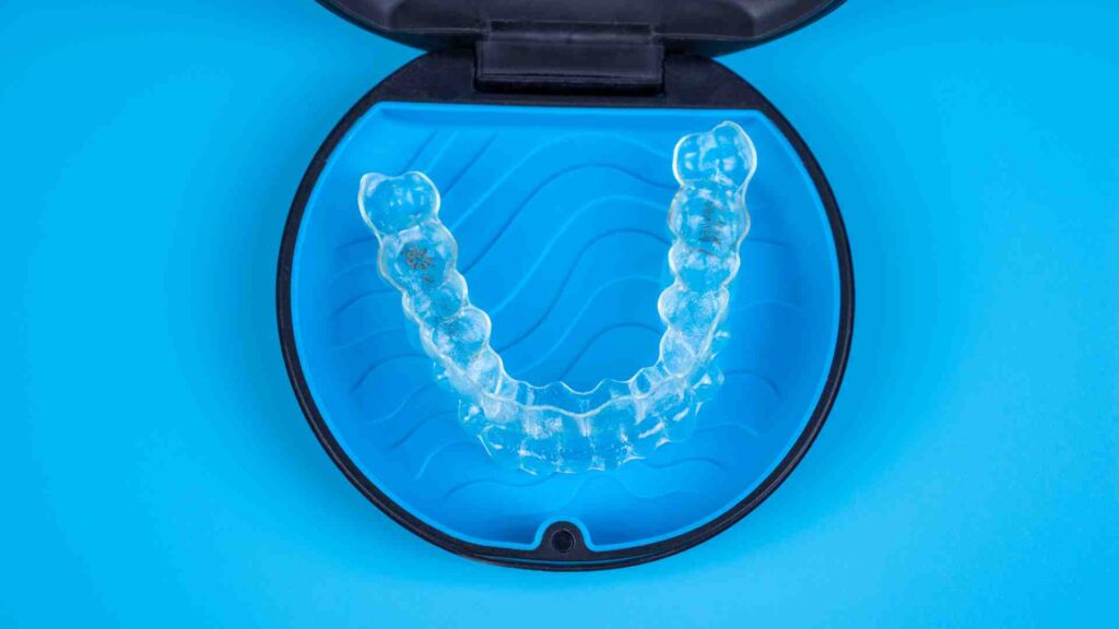 Signs You Need Orthodontic Treatment