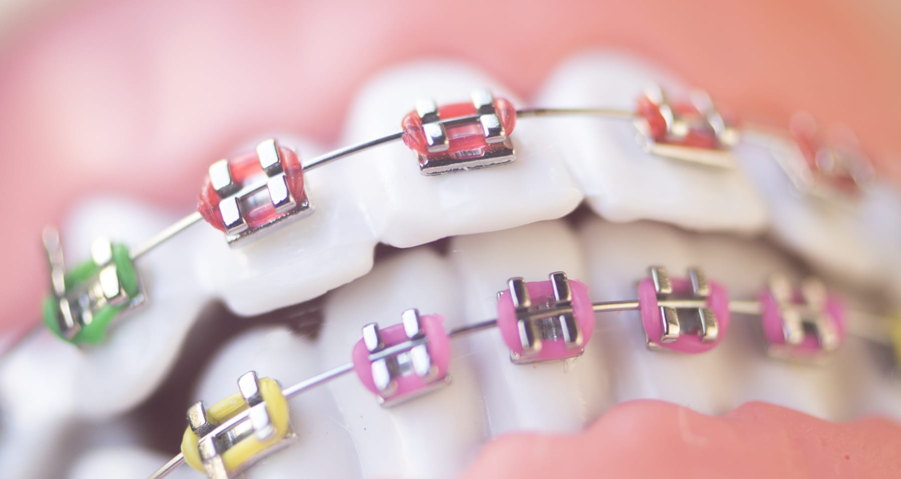The Most Advanced Tools and Techniques Used by Orthodontists Today