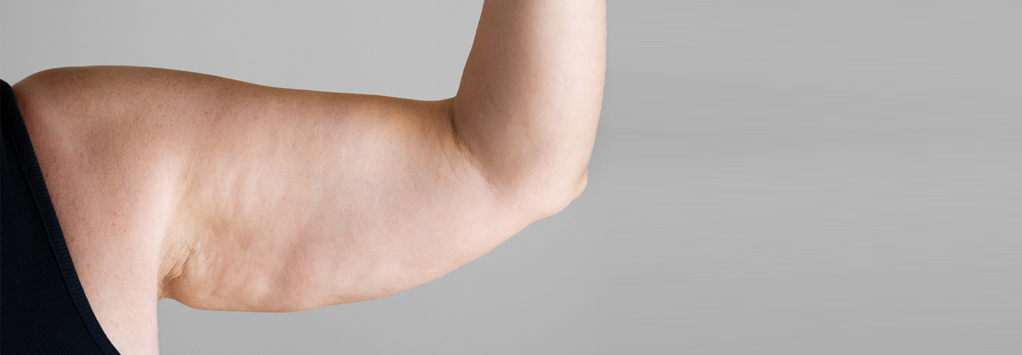 Velashape 3 Treatment in Dubai