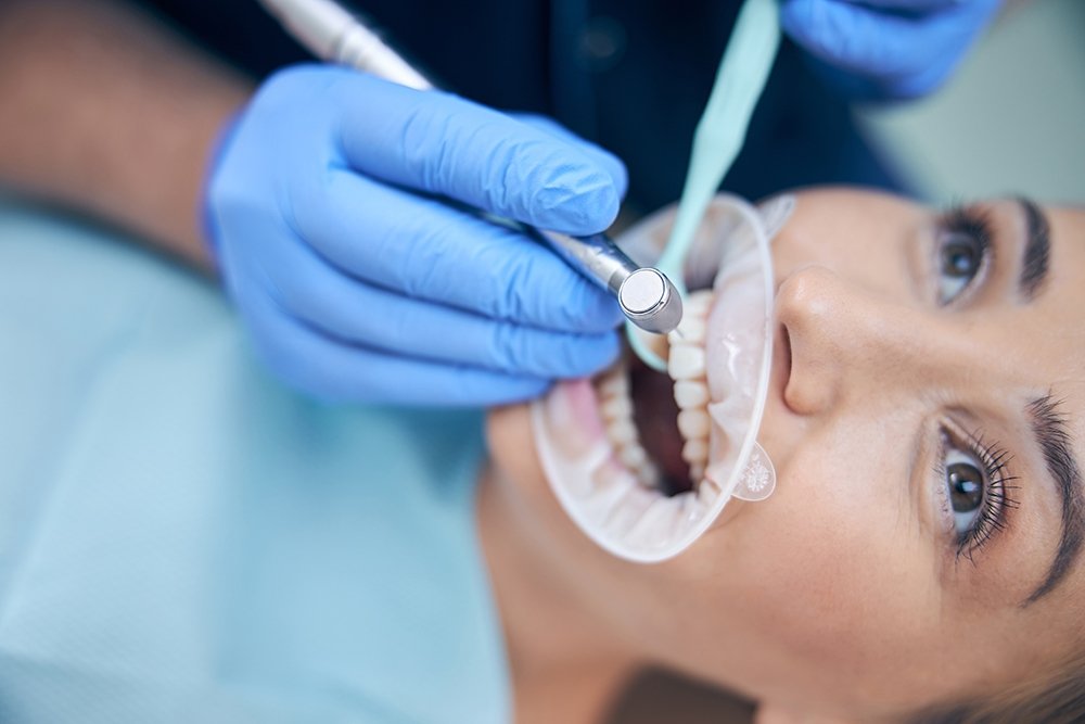Is Cosmetic Dentistry Worth the Investment Let’s Break It Down