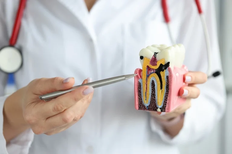 The Science Behind Root Canal Treatment How It Works