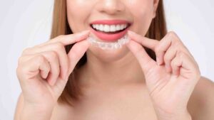 Le Traitement Invisalign est-il adapté pour les adolescents actifs ?