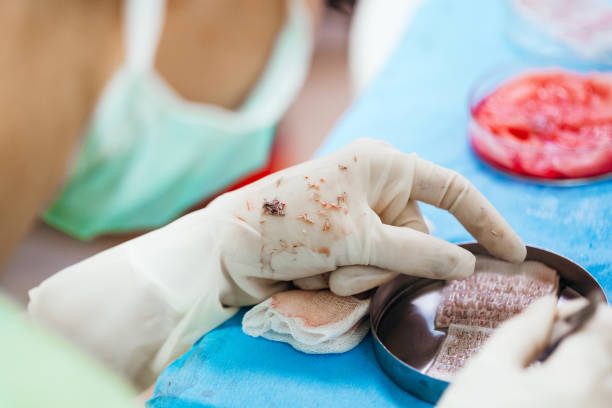 hair transplant cost in Dubai