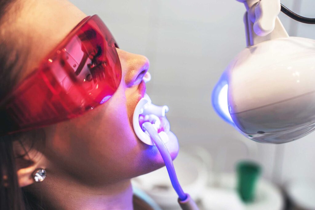 How Long Does Zoom Teeth Whitening Last