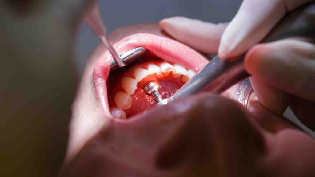 Que rechercher pour choisir un hygieniste dentaire à Genève ?