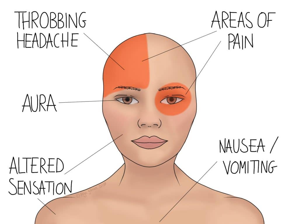 stress triggers migraines