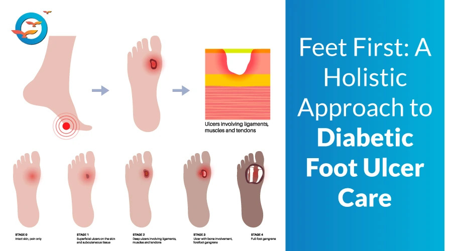 diabetic foot ulcer treatment