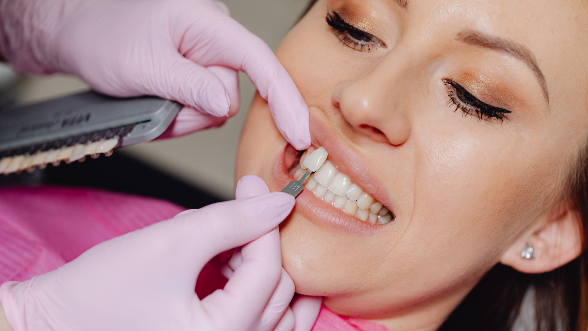 How Do Porcelain Veneers in Dubai Create Perfect Smiles