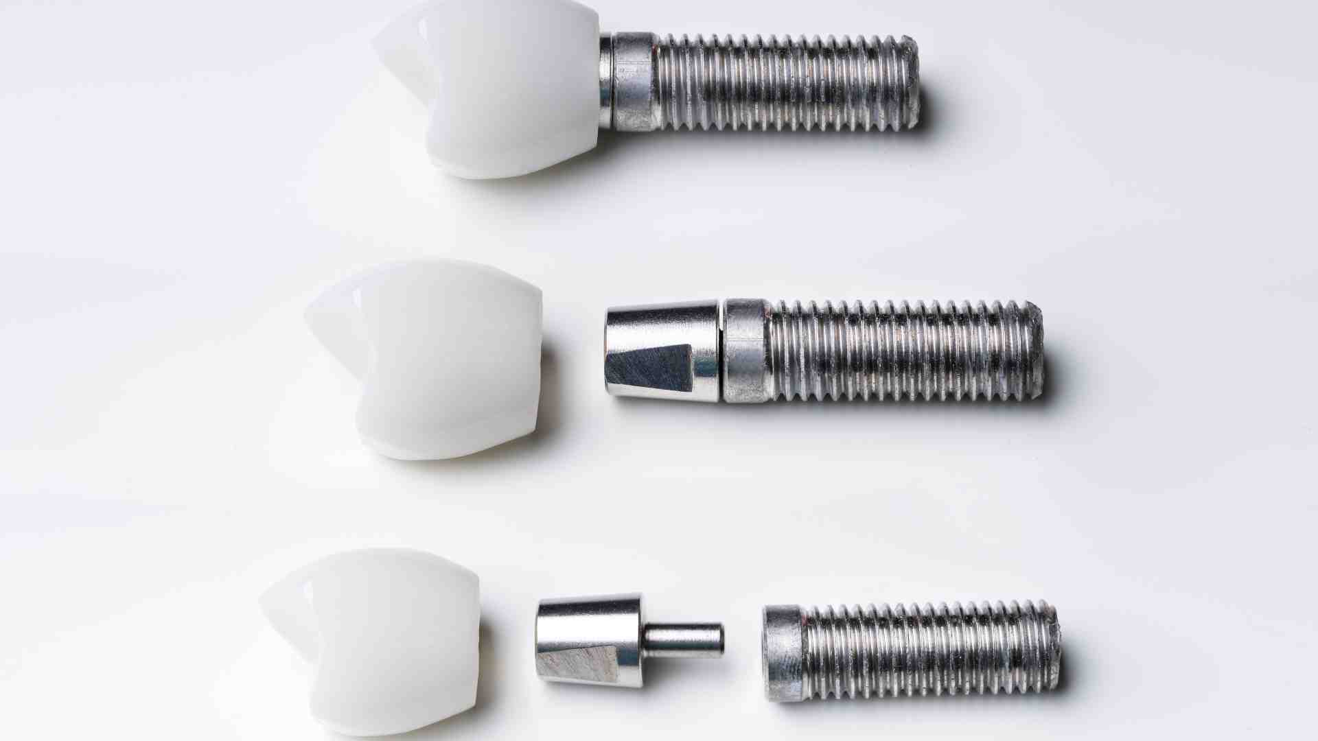 Implant Surgery Steps You Should Know