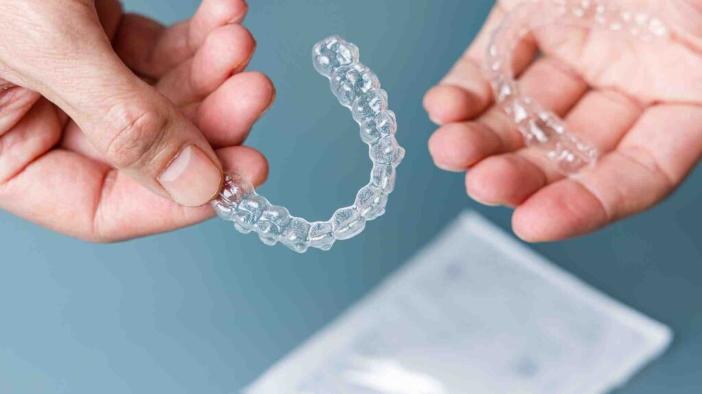 Step 5: Finish and Maintain Your Smile