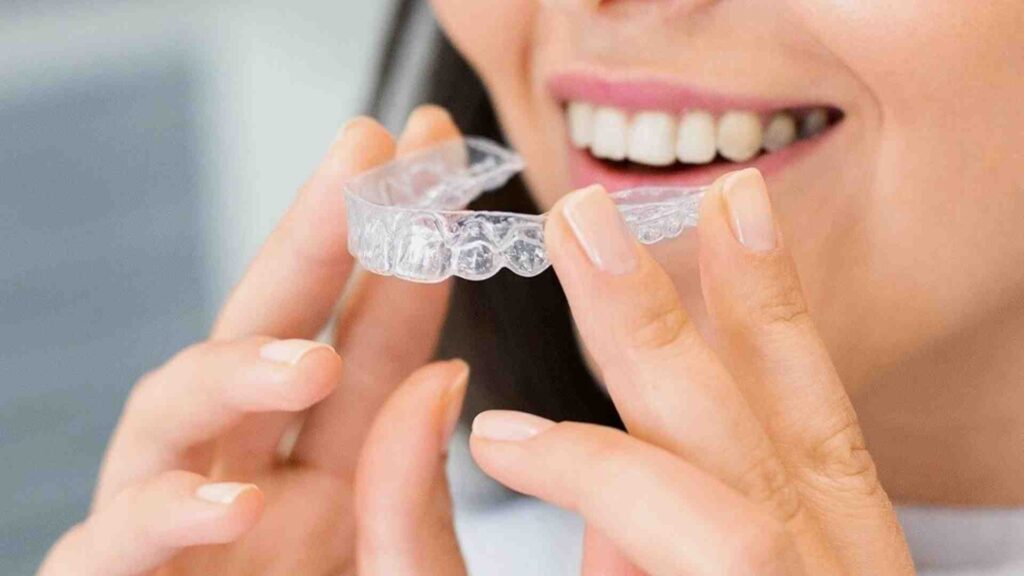 What Exactly Is Invisalign?