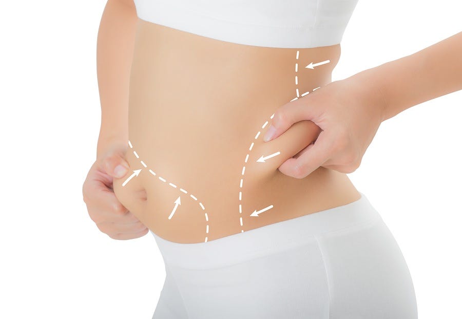 Mini Abdominoplasty Dubai