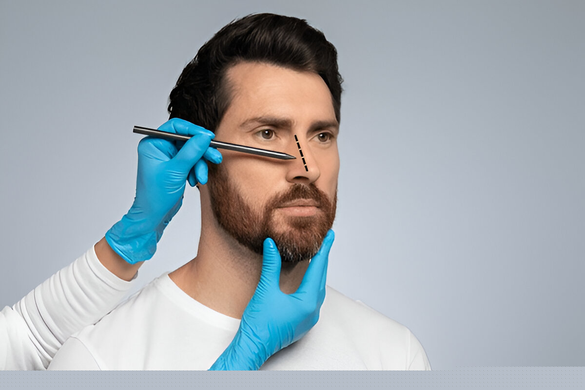 Rhinoplasty in Dubai