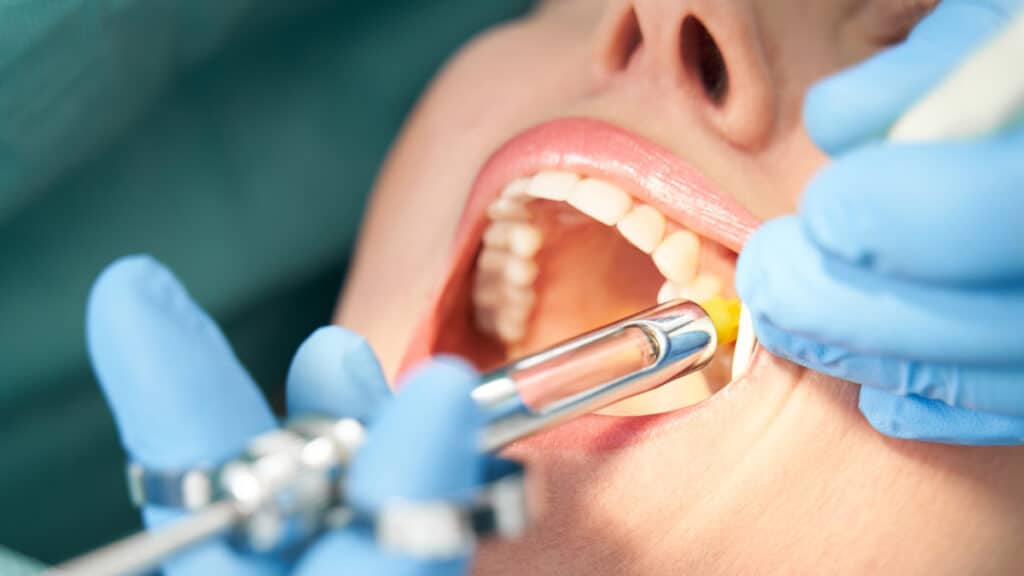 Pain Management During and After Tooth Removal