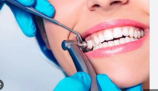 teeth whitening nj