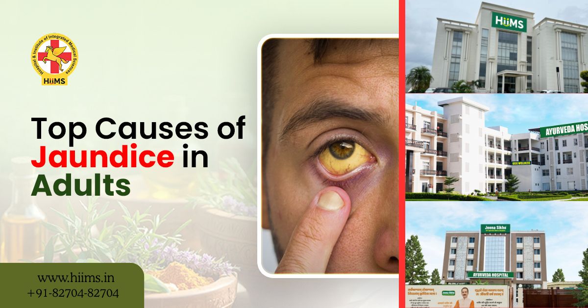 Causes of jaundice in adults