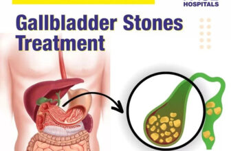Gallstone Treatment